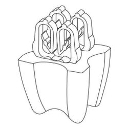 Rehau Abstandhalter Betonfuss 25mm, Gießbeton... REHAU-12090031001 4007360469504 (Abb. 1)